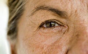 A szem sejtjeinek változása segíthet felismerni az Alzheimer-kórt