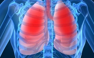 Minden tizedik ember halálát tüdőbetegség okozza